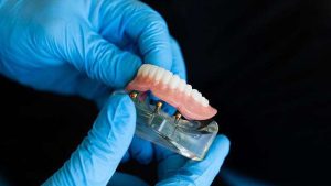  zobna proteza